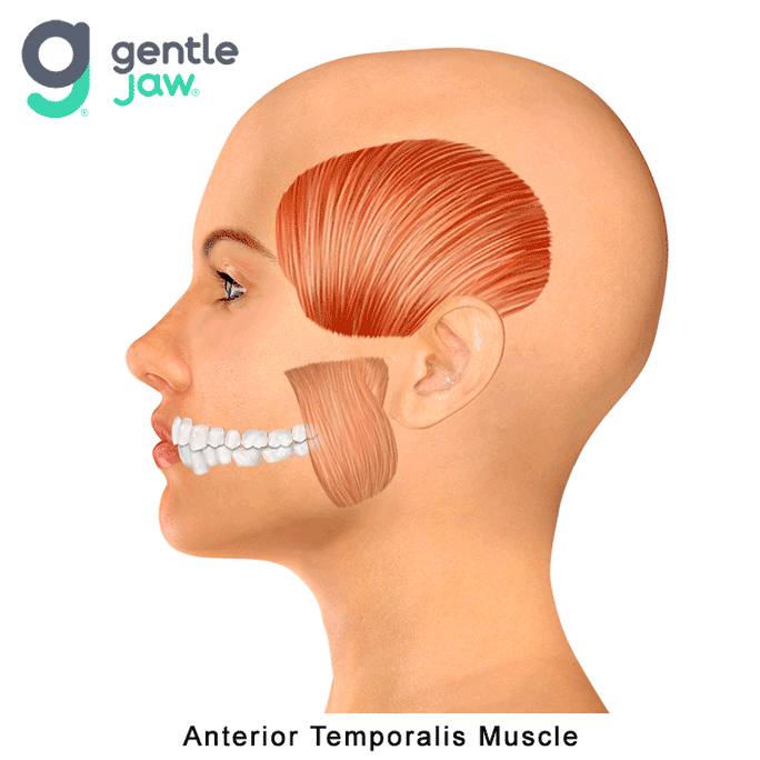 Muscle-Referral-Pattern-Temporalis-Anterior.gif