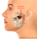 Jaw Dislocation Jaw Dislocation
