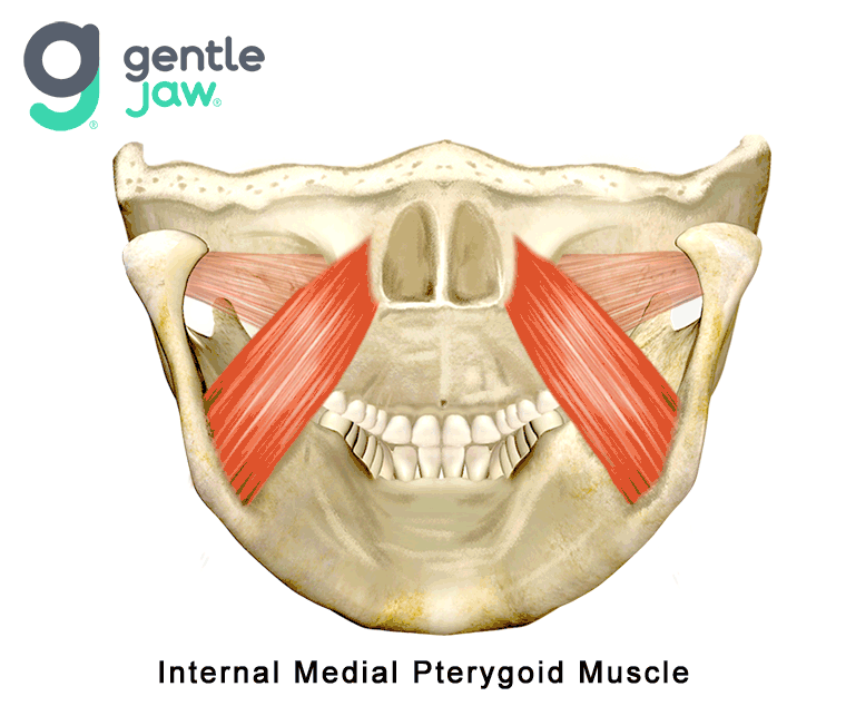 Muscle Referral Patterns Medial Pterygoid Internal